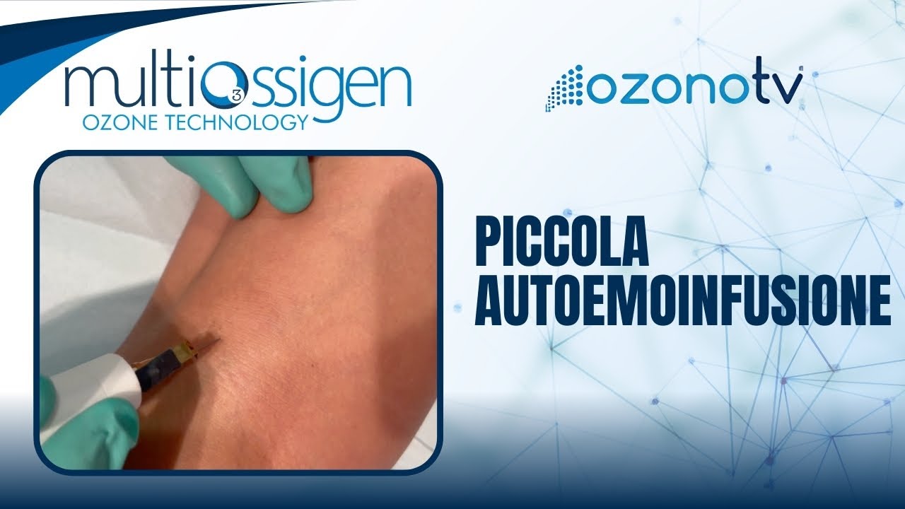Miniatura video: Ozono TV | Piccola autoemoinfusione