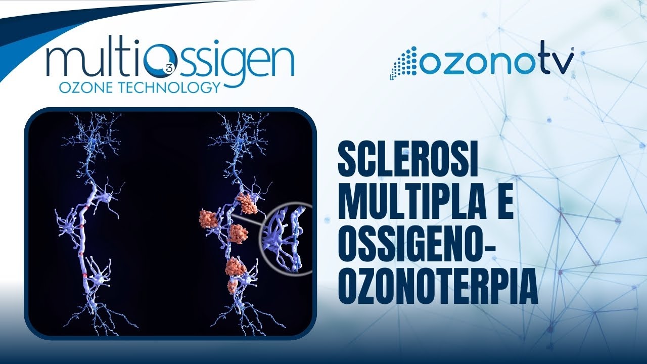 Miniatura video: Ozono TV | Sclerosi multipla